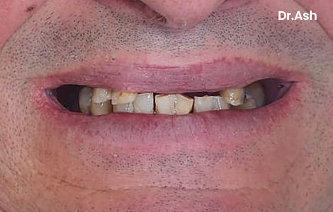 Before image