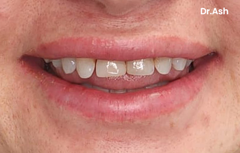 Before image